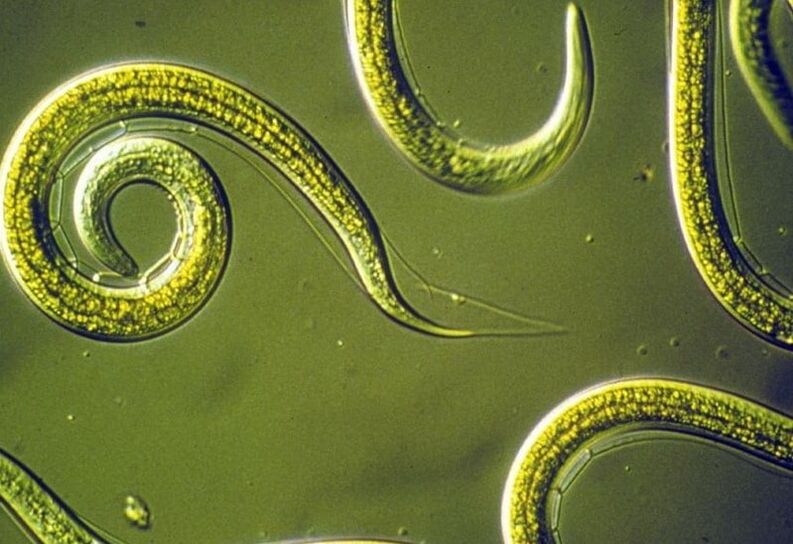круглые черви из организма человека