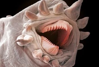 какие черви могут жить в организме человека